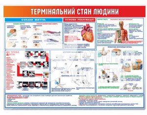 Стенд «Термінальний стан людини»