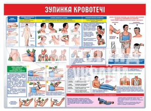 Стенд «Зупинка кровотечі»