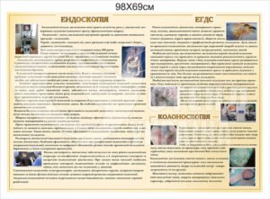 Стенд «Ендоскопія ЕГДС Колоноскопія»