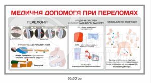 Медична допомога при переломах стенд з пластику
